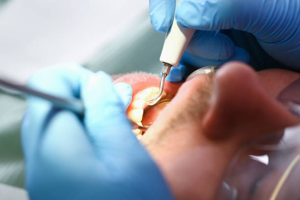 Best Emergency Dental Care for Abscessed Tooth in Shawneetown, IL